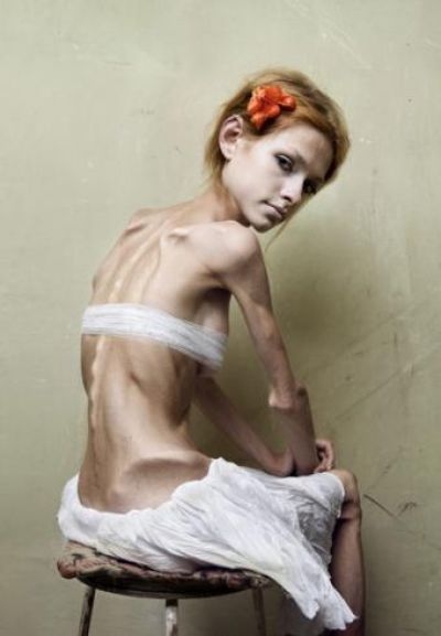 Anorexia si bulimia